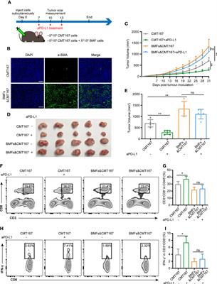 Wnt Inhibition Sensitizes PD-L1 Blockade Therapy by Overcoming Bone Marrow-Derived Myofibroblasts-Mediated <mark class="highlighted">Immune Resistance</mark> in Tumors